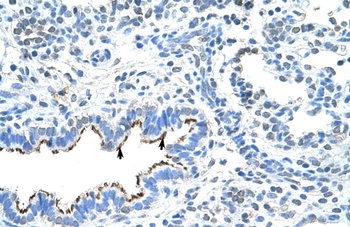 ZNF239 Antibody