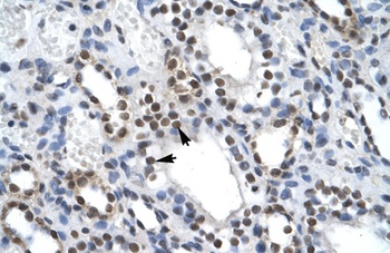 ILF2 Antibody