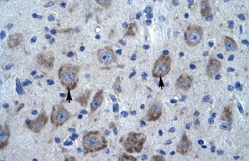 KCTD13 Antibody