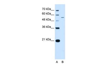 KCNQ2 Antibody