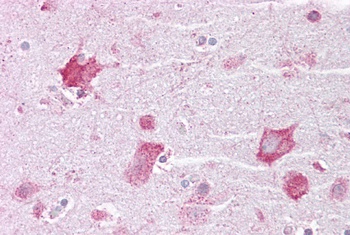 KCNQ2 Antibody