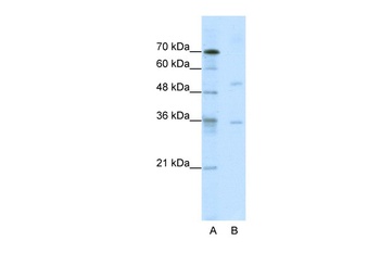 DIDO1 Antibody