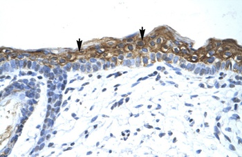 SUV420H1 Antibody