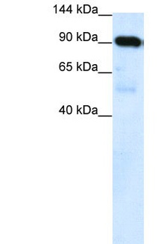 SUV420H1 Antibody