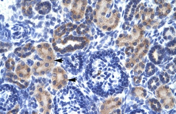 RNF141 Antibody
