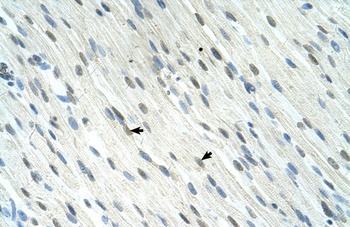SERTAD1 Antibody