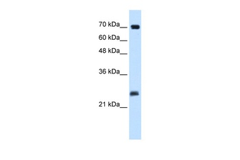 SERTAD1 Antibody
