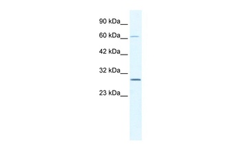 PARP11 Antibody