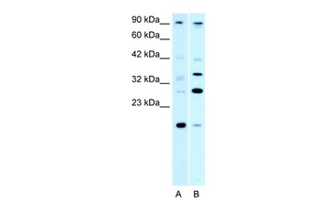 PARP11 Antibody