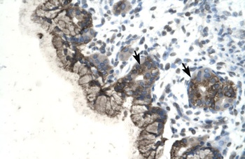 PARP3 Antibody