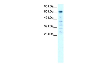 PARP3 Antibody