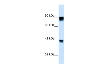 RB1 Antibody
