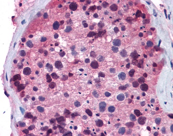 FOXO1 Antibody