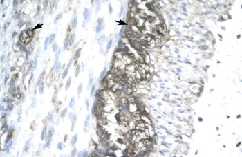 ACAT2 Antibody