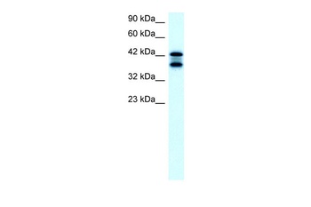 ACAT2 Antibody