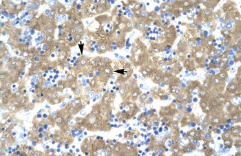 ACAT2 Antibody