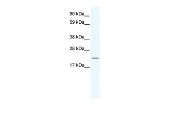 HTATIP2 Antibody