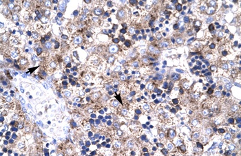 PAWR Antibody