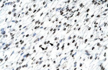 HOXB9 Antibody