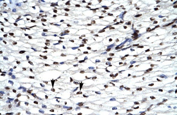 HIPK2 Antibody