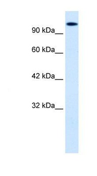HIPK2 Antibody