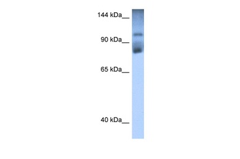 HIPK2 Antibody