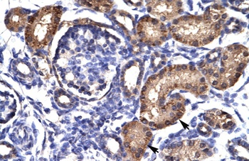 AHR Antibody