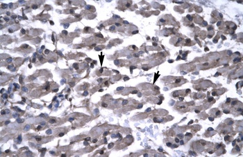 PAWR Antibody