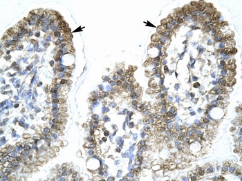 MYCBP Antibody