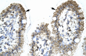 MYCBP Antibody