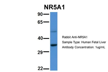 NR5A1 Antibody