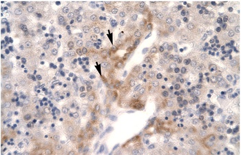 FOSL2 Antibody