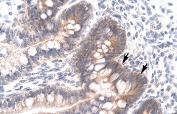 FOSL2 Antibody