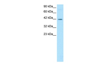 FOSL2 Antibody