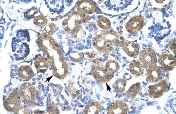 CBX4 Antibody
