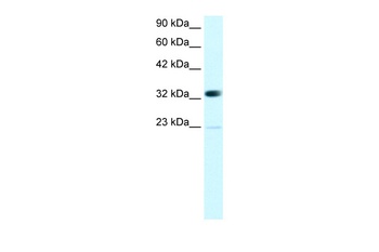 CBX4 Antibody