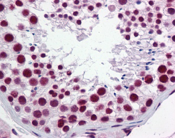 HNRPH1 Antibody