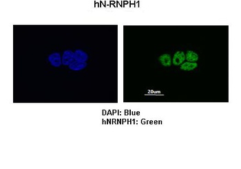HNRPH1 Antibody