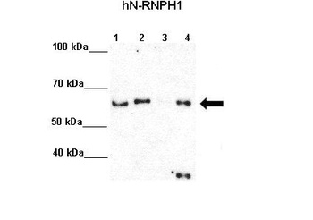 HNRPH1 Antibody