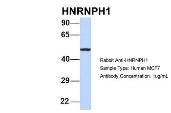 HNRPH1 Antibody