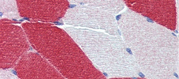 MYL6 Antibody
