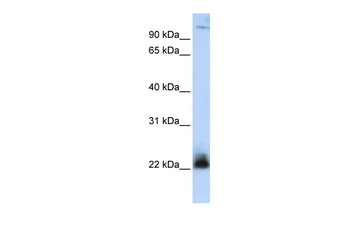 ITGB3BP Antibody