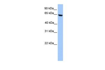 ACADVL Antibody