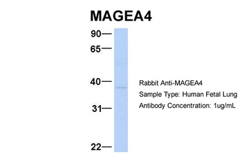 MAGEA4 Antibody