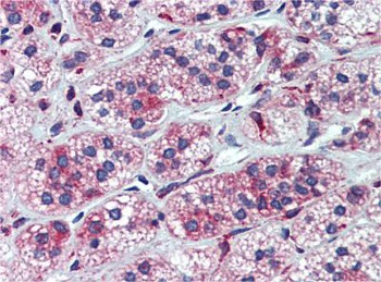 CYP11A1 Antibody