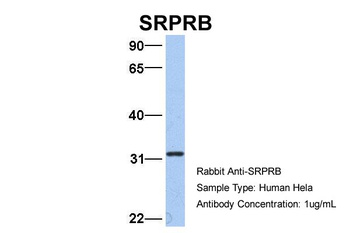 SRPRB Antibody
