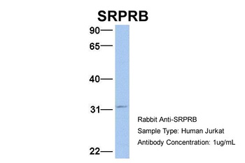 SRPRB Antibody