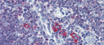 TFR2 Antibody