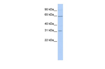 SLC27A2 Antibody