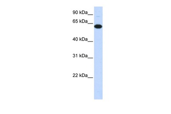 FBXO24 Antibody